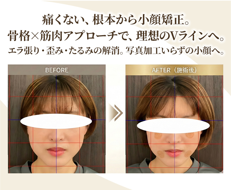 根本改善
