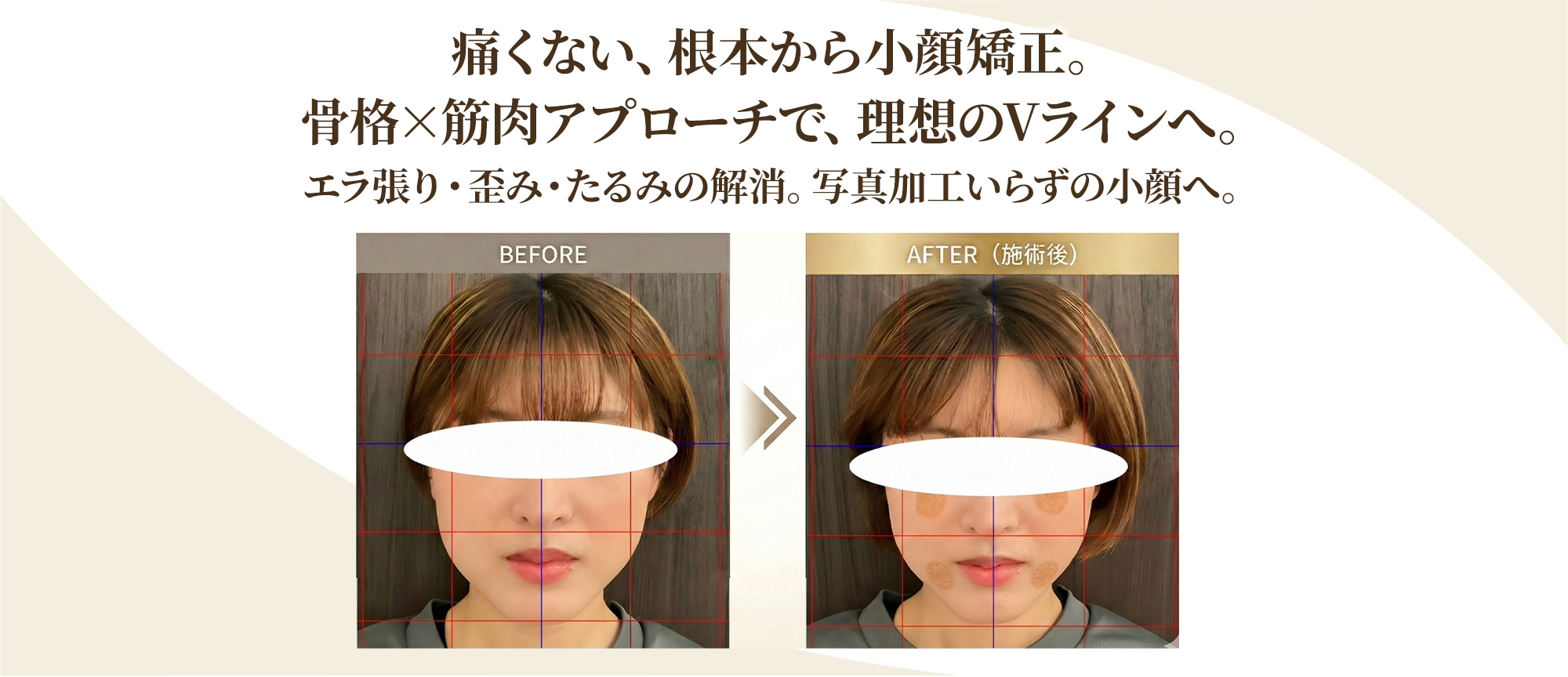 根本改善