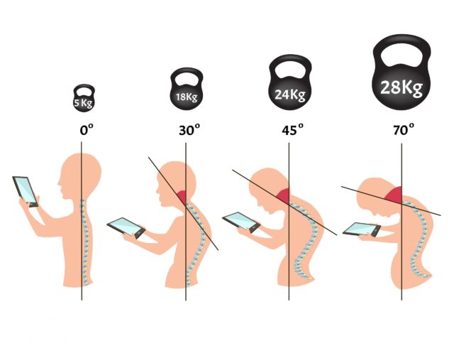【スマホ首】スマホ首（ストレートネック）が頭痛の原因？弁天町駅前整体院で首肩リセット！
